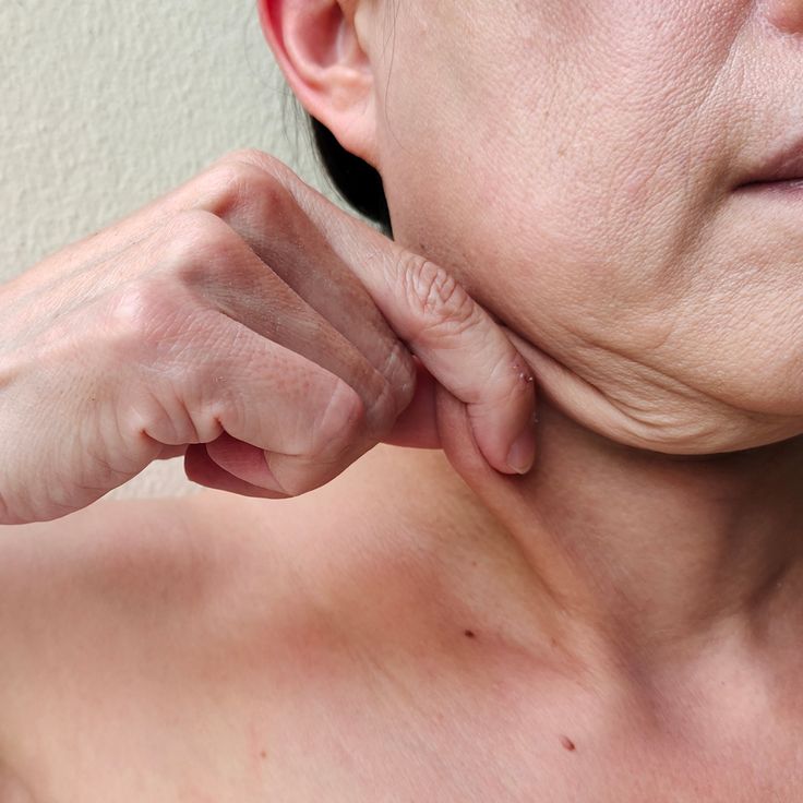 Is Ozempic Making Your Skin Look Older?